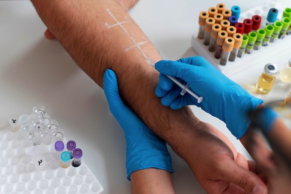 Lebensmittelallergie Test auf der Haut
